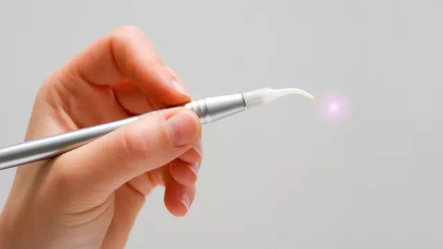 Dental-Laser Dental-Laser
